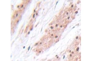 IHC-P analysis of Rat Tissue, with DAB staining. (PIK3AP1 Antikörper  (AA 397-650))