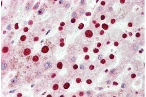 Immunohistochemistry (IHC) image for anti-Nuclear Receptor Subfamily 2, Group F, Member 6 (NR2F6) (N-Term) antibody (ABIN6754924)