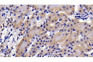 Detection of CASP3 in Mouse Kidney Tissue using Polyclonal Antibody to Caspase 3 (CASP3) (Caspase 3 Antikörper  (AA 29-175))