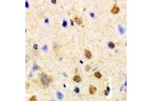 Immunohistochemical analysis of PSKH1 staining in human brain formalin fixed paraffin embedded tissue section. (PSKH1 Antikörper)