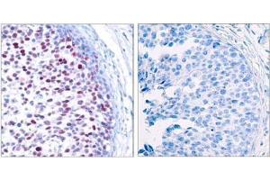 Image no. 3 for anti-Jun Proto-Oncogene (JUN) (pThr239) antibody (ABIN196652) (C-JUN Antikörper  (pThr239))