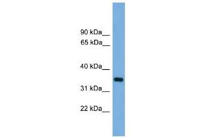 WB Suggested Anti-PRSS3 Antibody Titration: 0. (PRSS3 Antikörper  (N-Term))