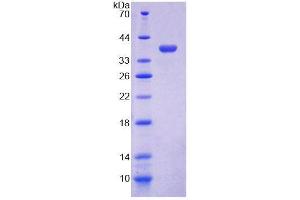 SDS-PAGE (SDS) image for Cytochrome C Oxidase Subunit VIc (COX6C) (AA 1-76) protein (His tag,GST tag) (ABIN6239478) (COX6C Protein (AA 1-76) (His tag,GST tag))