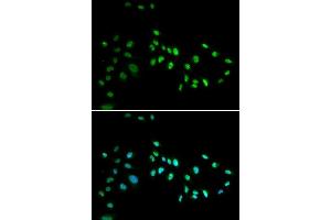 Immunofluorescence analysis of A549 cell using DNMT3A antibody. (DNMT3A Antikörper)