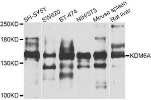 Western blot analysis of extracts of various cell lines, using KDM6A antibody. (KDM6A Antikörper)