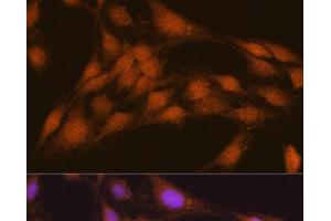 Immunofluorescence analysis of C6 cells using NRBF2 Polyclonal Antibody at dilution of 1:100. (NRBF2 Antikörper)