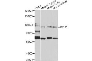 Western blot analysis of extracts of various cell lines, using DVL2 Antibody (ABIN5975825) at 1/1000 dilution. (DVL2 Antikörper)