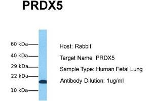 Host: Rabbit Target Name: PRDX5 Sample Tissue: Human Fetal Lung Antibody Dilution: 1. (Peroxiredoxin 5 Antikörper  (Middle Region))
