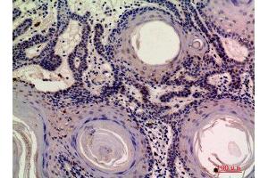 Immunohistochemistry (IHC) analysis of paraffin-embedded Human Skin, antibody was diluted at 1:200. (MOB3A/B Antikörper)
