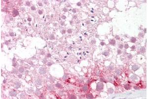 Anti-ABCD3 / PMP70 antibody IHC staining of human testis. (PMP70 Antikörper  (AA 526-539))