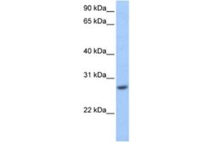 Western Blotting (WB) image for anti-Glutathione S-Transferase mu 3 (Brain) (GSTM3) antibody (ABIN2463566)