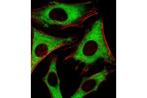 Fluorescent image of Hela cells stained with RPLP0P6 Antibody (N-term) (ABIN1881762 and ABIN2843386). (RPLP0P6 Antikörper  (N-Term))