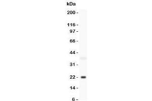 Western blot testing of Bid antbody and mouse brain lysate. (BID Antikörper  (C-Term))
