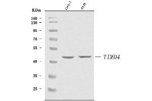 Western blot analysis of TIM 4/TIMD4 using anti-TIM 4/TIMD4 antibody (ABIN7600827).