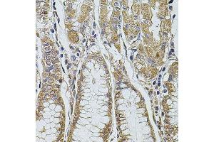 Immunohistochemistry (Paraffin-embedded Sections) (IHC (p)) image for anti-Programmed Cell Death 6 Interacting Protein (PDCD6IP) (AA 1-180) antibody (ABIN1512565)