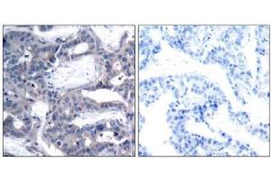 Image no. 3 for anti-Mitogen-Activated Protein Kinase Kinase 2 (MAP2K2) (pThr394) antibody (ABIN196623) (MEK2 Antikörper  (pThr394))