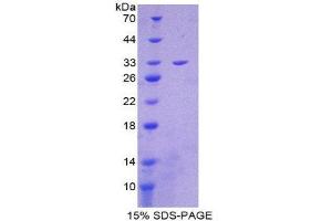SDS-PAGE (SDS) image for Citrate Synthase (CS) (AA 174-428) protein (His tag) (ABIN1878675)