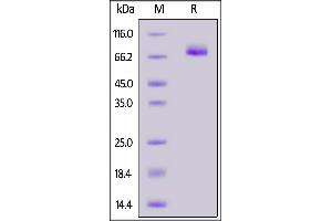 Mouse CD36, His Tag on  under reducing (R) condition. (CD36 Protein (CD36) (AA 30-439) (His tag))