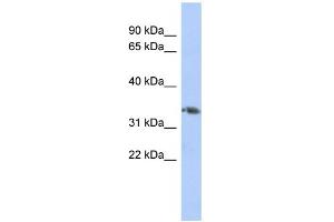 WB Suggested Anti-HOXD10 Antibody Titration:  0. (HOXD10 Antikörper  (Middle Region))