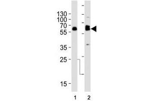 Western blot analysis of lysate from (1) SW480 and (2) U-87 MG cell line using TH antibody at 1:1000.