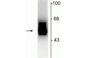 Western Blotting (WB) image for anti-gamma-aminobutyric Acid (GABA) A Receptor, beta 2 (GABRB2) (Cytoplasmic Loop) antibody (ABIN361447)