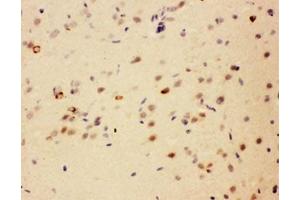 IHC testing of FFPE rat brain with SIP antibody. (CACYBP Antikörper  (Middle Region))