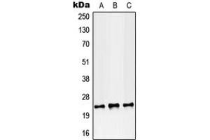 Western blot analysis of RAB38 expression in MCF7 (A), SP2/0 (B), PC12 (C) whole cell lysates.