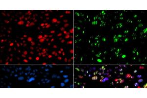 Immunofluorescence analysis of GFP-RNF168 transgenic U2OS cells using PNKP Polyclonal Antibody (PNKP Antikörper)