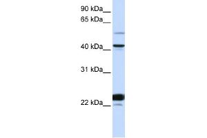 WB Suggested Anti-EVX1 Antibody Titration: 0.