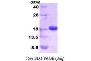 Figure annotation denotes ug of protein loaded and % gel used. (SUMO2 Protein (AA 1-93))