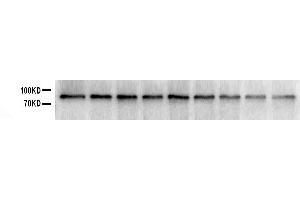 Western blot analysis of SOX5 using anti-SOX5 antibody .