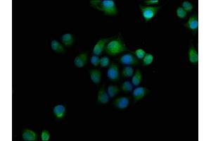 Immunofluorescence staining of Hela cells with ABIN7154719 at 1:166, counter-stained with DAPI. (GNAT3 Antikörper  (AA 2-354))