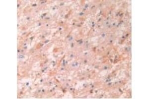 Immunohistochemistry (Paraffin-embedded Sections) (IHC (p)) image for Rabbit anti-Human IgG4 (AA 222-327) antibody (ABIN2862700)