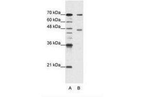 Image no. 2 for anti-Poly(A) Binding Protein, Cytoplasmic 4 (Inducible Form) (PABPC4) (AA 181-230) antibody (ABIN202848) (PABPC4 Antikörper  (AA 181-230))