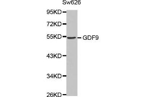 Western blot analysis of extracts of Sw626 cell line, using GDF9 antibody. (GDF9 Antikörper  (AA 205-454))