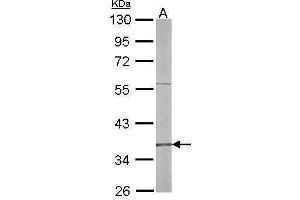 Western Blotting (WB) image for anti-Replication Factor C (Activator 1) 4, 37kDa (RFC4) antibody (ABIN2855757)