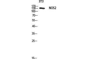 Western Blotting (WB) image for anti-Nitric Oxide Synthase 2, Inducible (NOS2) (Thr177) antibody (ABIN6285268)