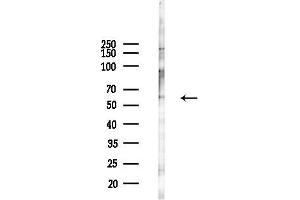 anti-Solute Carrier Family 22 Member 4 (SLC22A4) (C-Term) antibody