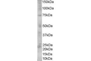 Image no. 1 for anti-Premelanosome Protein (PMEL) (C-Term) antibody (ABIN374704) (Melanoma gp100 Antikörper  (C-Term))