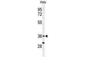 Western blot analysis of SUMF1 Antibody (C-Term) in Hela cell line lysates (35µg/lane). (SUMF1 Antikörper  (C-Term))