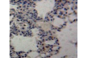 Immunohistochemistry (IHC) image for anti-Tumor Necrosis Factor (Ligand) Superfamily, Member 13 (TNFSF13) (AA 96-241) antibody (ABIN1078631)