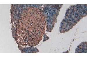 Immunohistochemistry (IHC) image for anti-Endothelial PAS Domain Protein 1 (EPAS1) (AA 21-336) antibody (ABIN7435526)