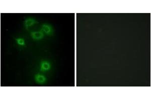 Immunofluorescence analysis of A549 cells, using BMX Antibody. (BMX Antikörper  (AA 11-60))