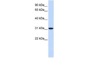 Western Blotting (WB) image for anti-Carbonic Anhydrase VIII (CA8) antibody (ABIN2458629) (CA8 Antikörper)