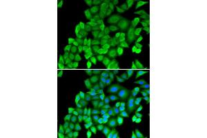 Immunofluorescence (IF) image for anti-Proteasome (Prosome, Macropain) Subunit, beta Type, 4 (PSMB4) antibody (ABIN1876898)