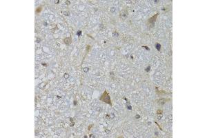 Immunohistochemistry of paraffin-embedded mouse brain using CHN1 antibody (ABIN5974737) at dilution of 1/100 (40x lens). (CHN1 Antikörper)