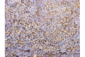Immunostaining (ISt) image for anti-Major Histocompatibility Complex, Class II, DR beta 4 (HLA-DRB4) (AA 30-266) antibody (ABIN561273)
