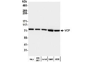 Western Blotting (WB) image for anti-Valosin Containing Protein (VCP) (C-Term) antibody (ABIN7452151)