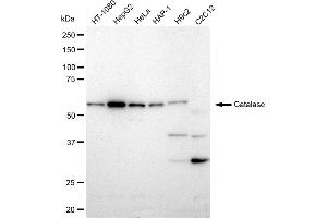 Western blotting analysis using Catalase antibody (ABIN7797918).