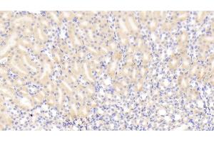 Immunohistochemistry (IHC) image for anti-Glutaminase 2 (Liver, Mitochondrial) (GLS2) (AA 154-479) antibody (ABIN7436594)